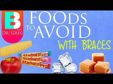 Foods to Avoid When Wearing Braces