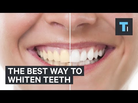 What Causes Teeth to Turn Yellow?