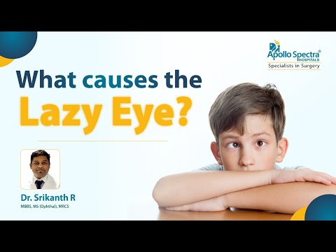Causes of Adult-Onset Lazy Eye